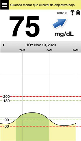 this is 50 | 50 image